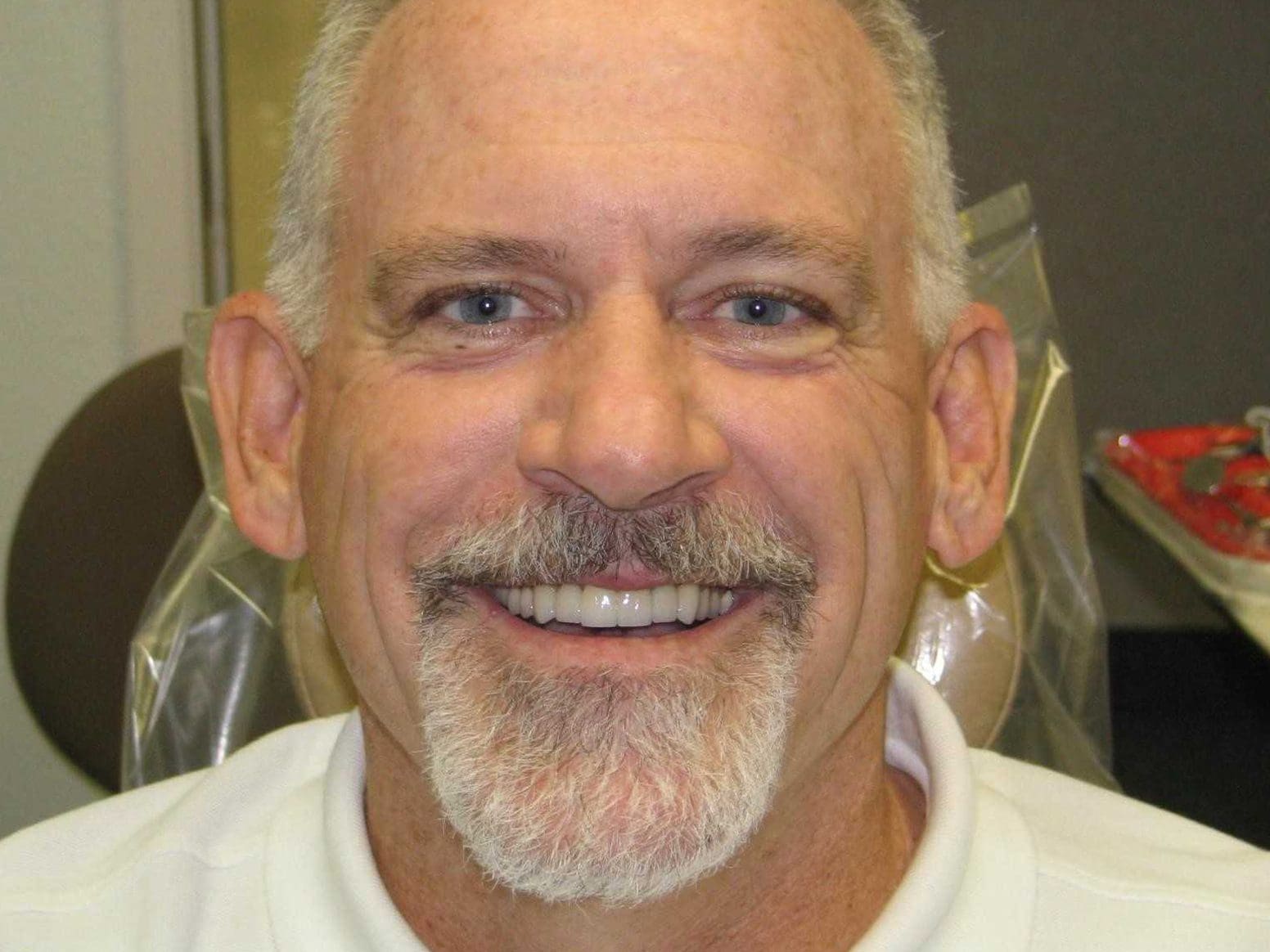 cosmetic-dentistry-case-1-after-new