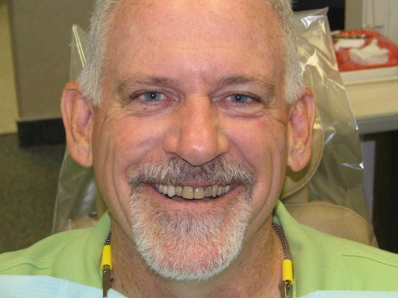 cosmetic-dentistry-case-1-before-new cosmetic-dentistry-case-1-before-new