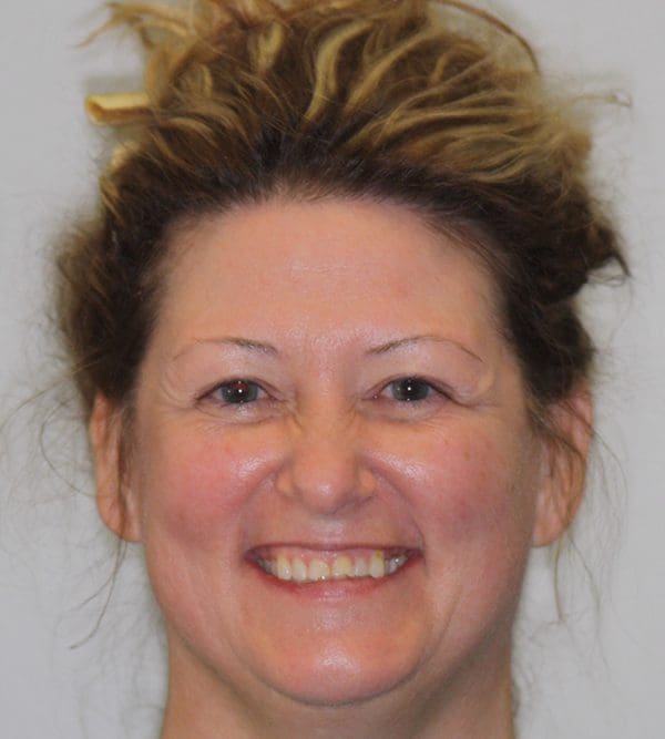 Dentist in Fair Oaks