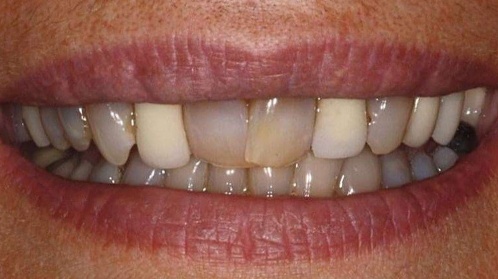 Untitled design – 2 Untitled design - 2