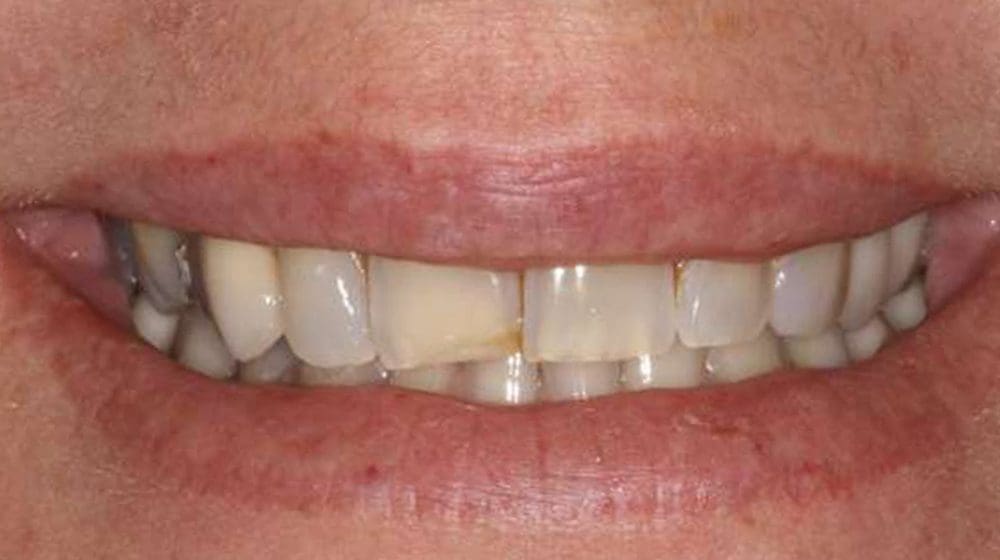 Untitled design – 4 Untitled design - 4