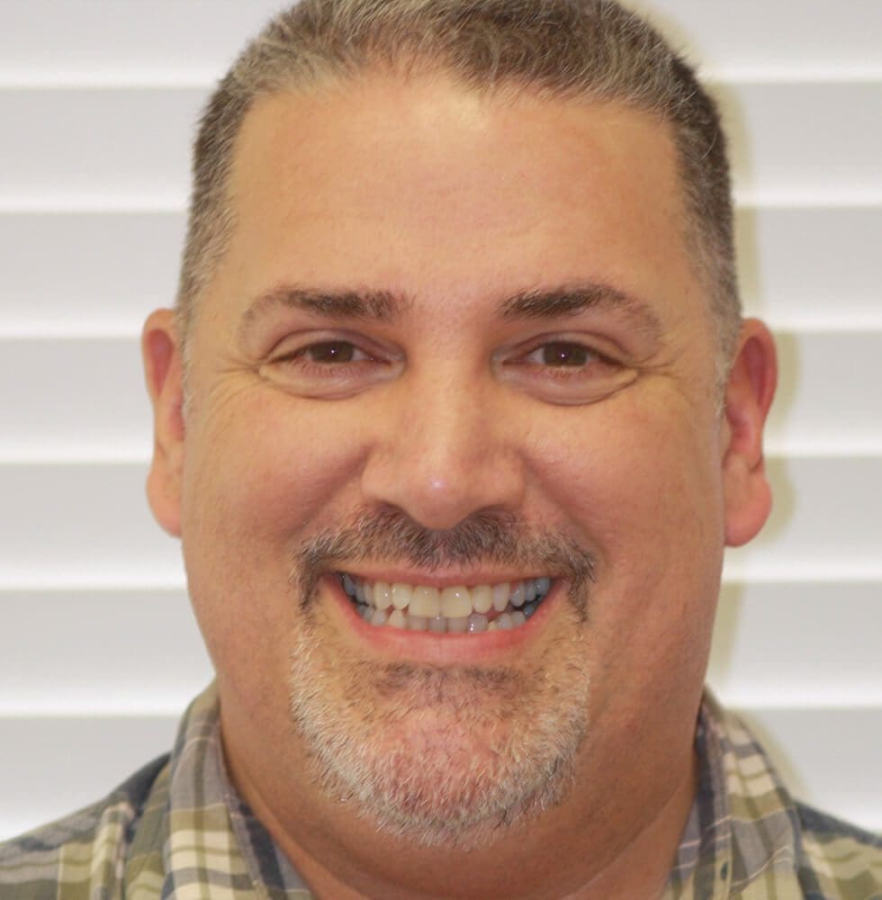 invisalign-bna-case-19-before invisalign-bna-case-19-before